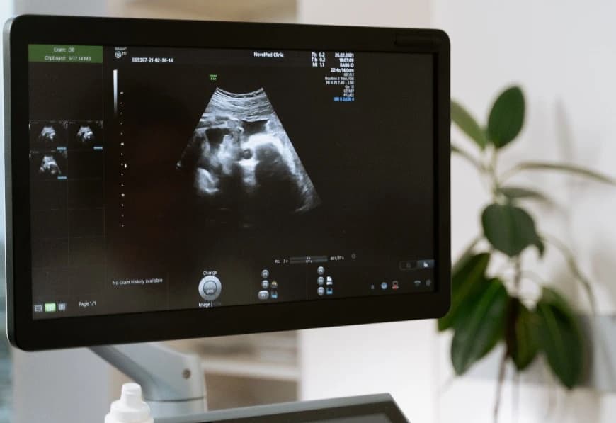 Ultrasonography Monitor Display & 3D 4D USG Scans