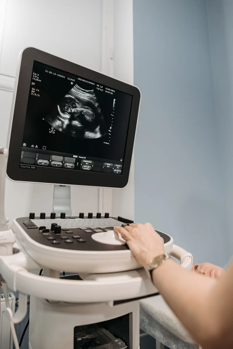 High-End 3D/4D Ultrasonography Diagnostic Machine Console at Katrawala Diagnostic Centre